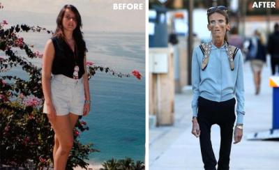 skinniest-woman-in-the-world